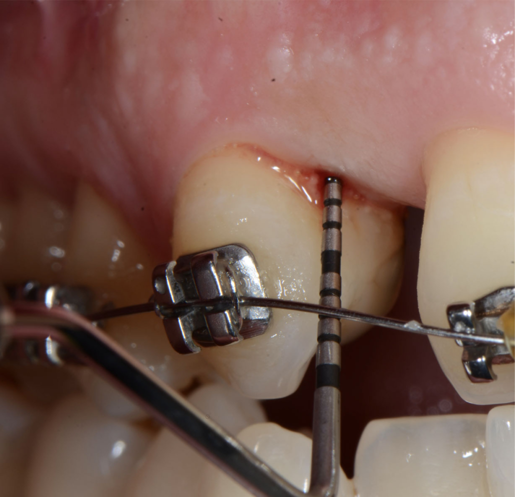 corso parodontologia